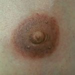 Aureola copia