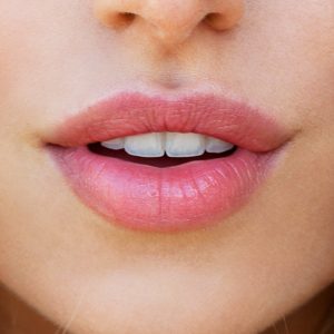 Aumento de labios