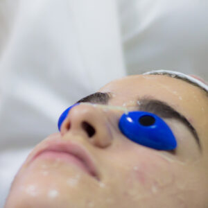 Fototerapia anti-acné