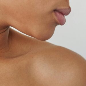 Marcación mandibular completa